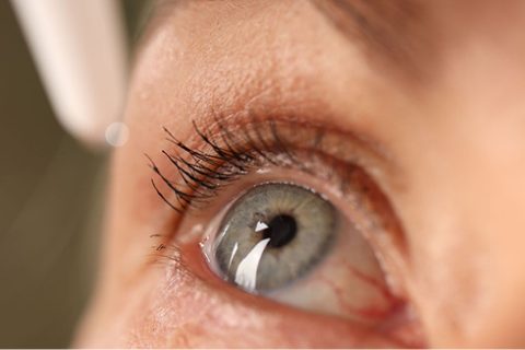 Cataract Surgery